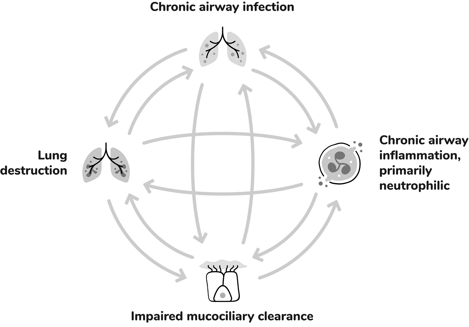 How the 4 drivers of bronchiectasis contribute to disease progression