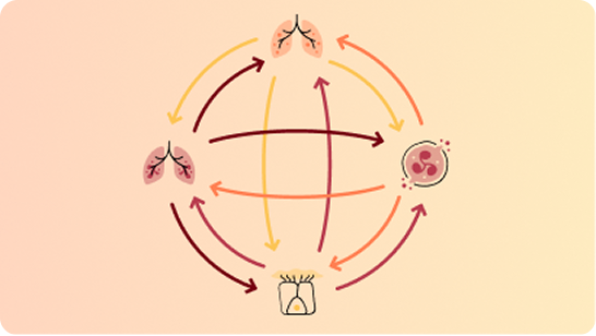 A graphic showing the vicious vortex, an interconnected network between four icons, representing chronic airway inflammation, chronic airway infection, impaired mucociliary clearance and lung destruction